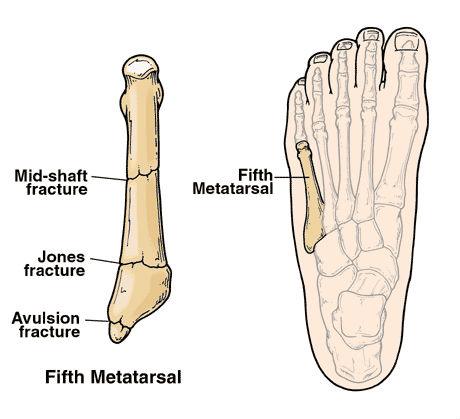 5m